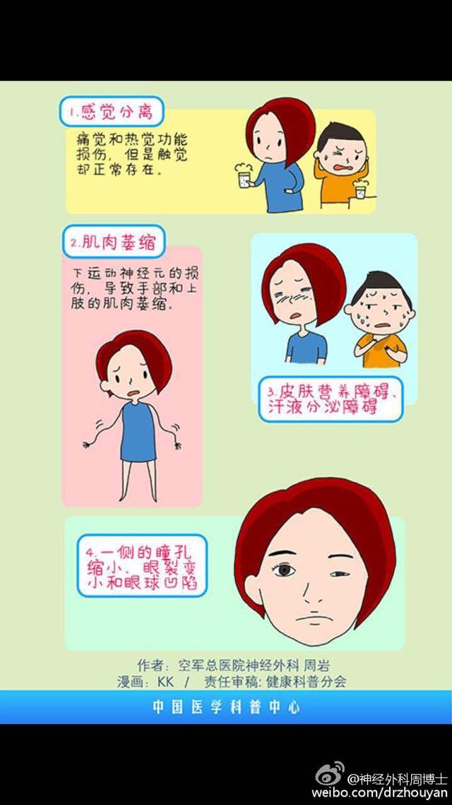 漫画科普 &ldquo;麻小&rdquo;的罪证 脊髓空洞症