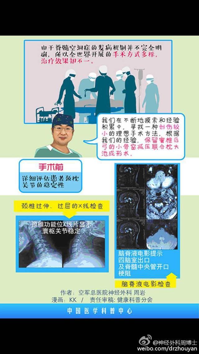 漫画科普 &ldquo;麻小&rdquo;的罪证 脊髓空洞症