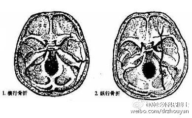 我为什么会&ldquo;晕&rdquo;？ &ldquo;了解眩晕&rdquo;是正确认识&ldquo;眩晕&rdquo;的重要开始