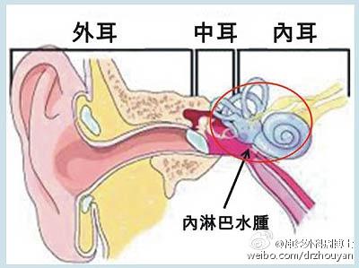 我为什么会&ldquo;晕&rdquo;？ &ldquo;了解眩晕&rdquo;是正确认识&ldquo;眩晕&rdquo;的重要开始
