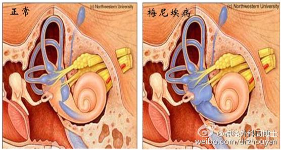 我为什么会&ldquo;晕&rdquo;？ &ldquo;了解眩晕&rdquo;是正确认识&ldquo;眩晕&rdquo;的重要开始