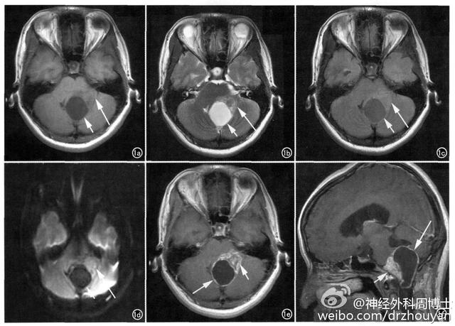 我为什么会&ldquo;晕&rdquo;？ &ldquo;了解眩晕&rdquo;是正确认识&ldquo;眩晕&rdquo;的重要开始