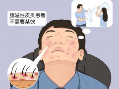 脂溢性皮炎需要禁欲吗
