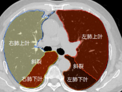 左肺上叶各段结构图片