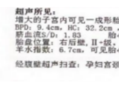 脐带绕颈，危险吗？还能顺产吗？