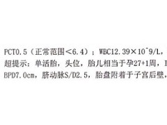 面对脐带绕颈，别太担心了！