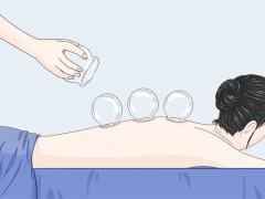 什么样的人贴三伏贴