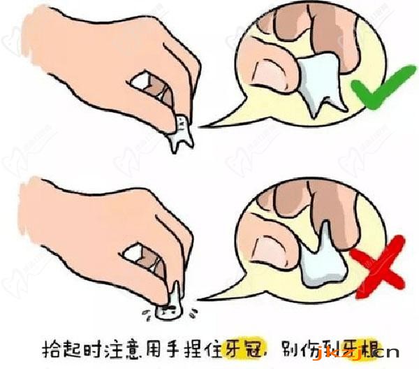 孩子牙齿断了只剩根部怎么办