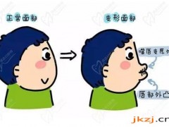 儿童什么时候可以矫正牙齿？告诉你儿童牙齿做早期干预好不好