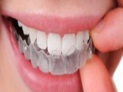 牙齿矫正什么时候做？牙齿矫正后恢复期是多久？