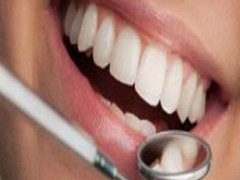 牙齿矫正器有哪些？牙齿矫正的价格贵不贵？