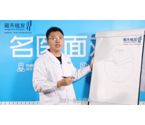 雍禾植发：如何进行方案设计（一）