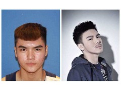 种植胡须价格多少钱和常见问题