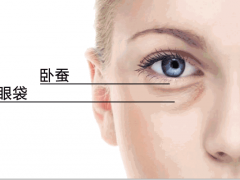 卧蚕眼是什么？整形卧蚕眼价格？