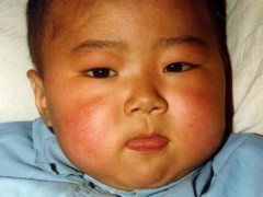 中医望色之面色红黄，吐弄红舌