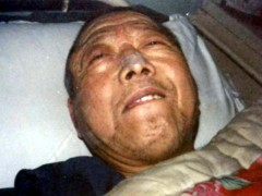 中医望色之面色红黄，目暗睛迷