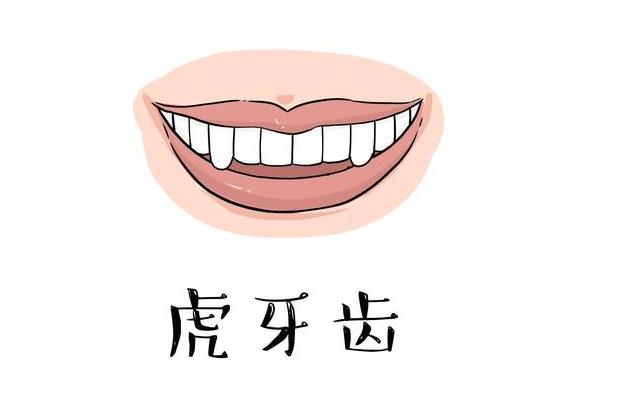 虎牙