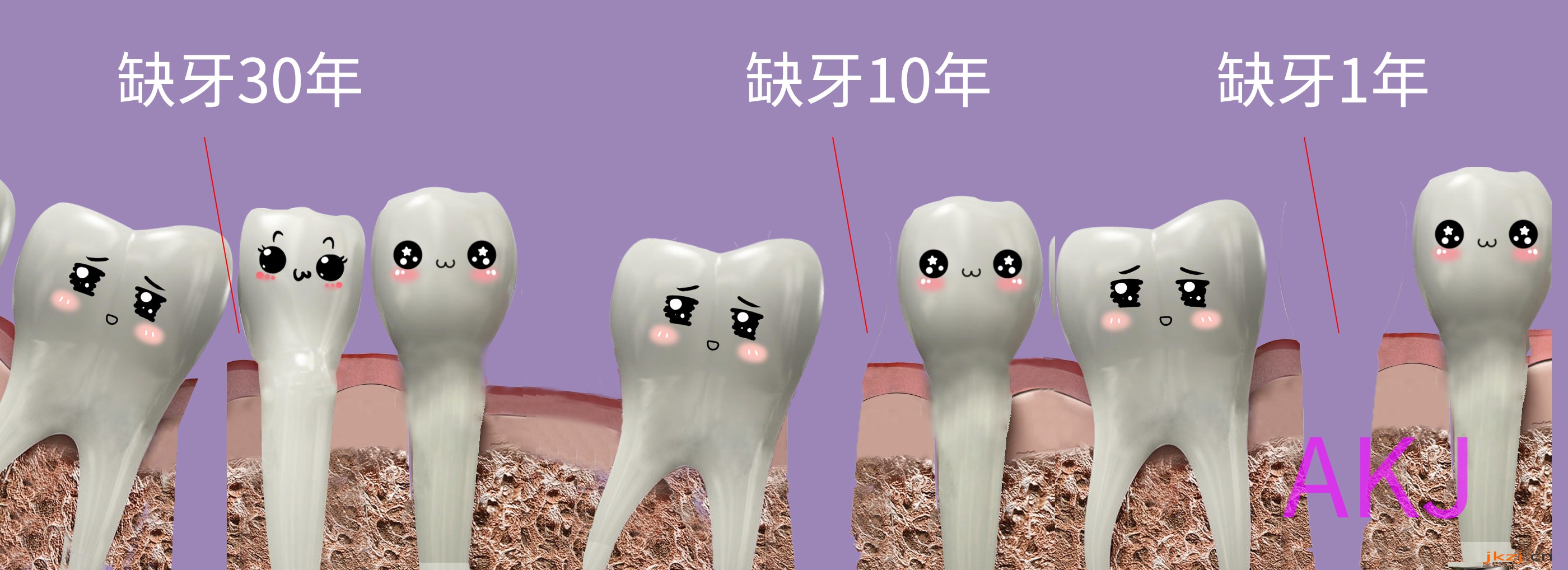 缺牙