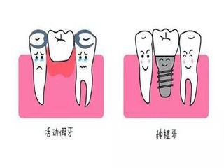 拔门牙