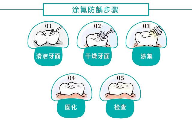 涂氟步骤