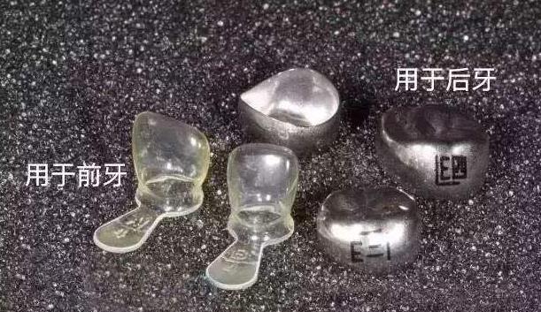 儿童预成冠