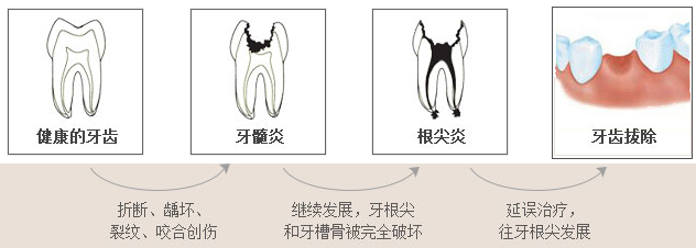 乳牙治疗