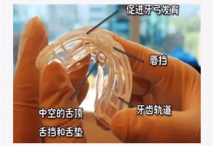 mrc肌功能矫治器