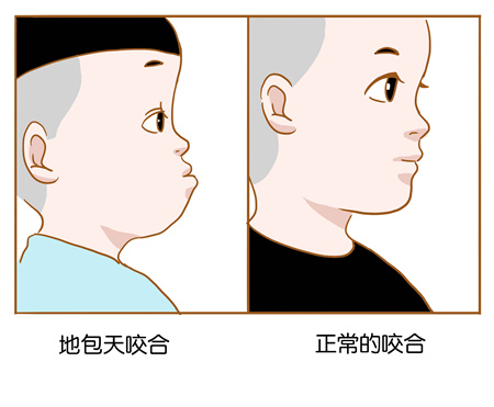 兜齿的咬合