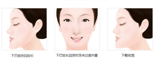 乳牙反合治疗后会复发吗