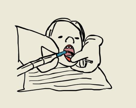 小孩牙齿矫正
