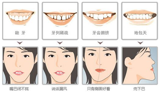 孩子牙齿矫正较佳年龄