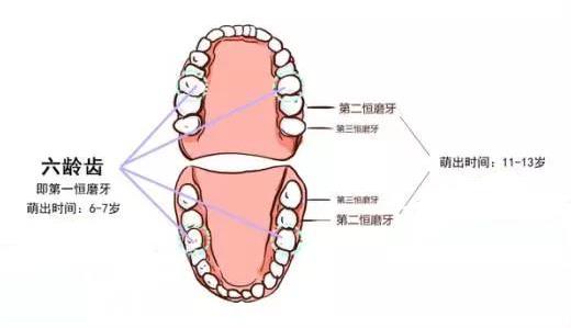 窝沟封闭哪些牙齿哪个年龄做好