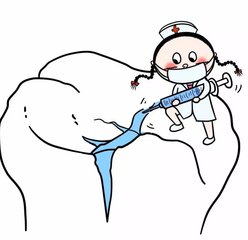 窝沟封闭有必要吗