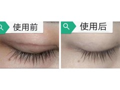 吕易圣扫疤烫皮肤抑菌液图3