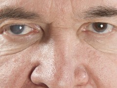 怎样判断自己干眼症