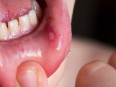 夏季上火易口臭这几种食物能挽救
