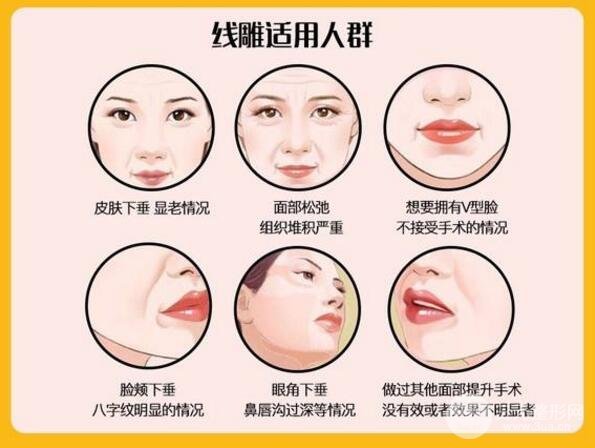 韩国面部除皱手术火到爆,带你了解一下这个抗衰手术~
