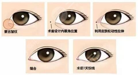 威海可人整形美容价格表新出炉 