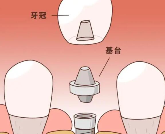 昆明地区口腔医院优选评析，服务实力与收费标准一览！
