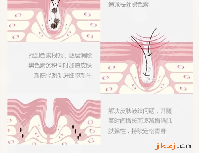 点阵激光美容什么时间适合做?