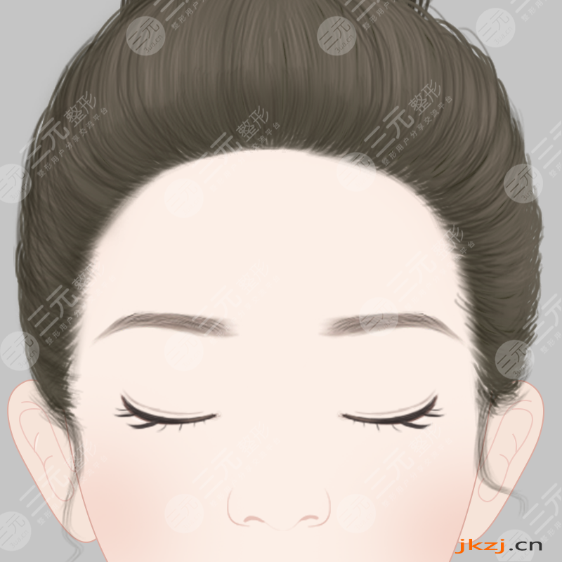 广州美恩徐威强院长颧骨磨骨术后90天果图