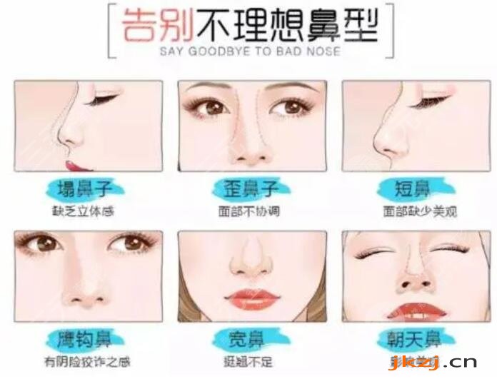硅胶假体隆鼻手术
