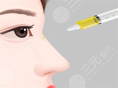 南宁华美医疗美容整形怎么样？医疗团队/隆鼻、双眼皮整形案例~