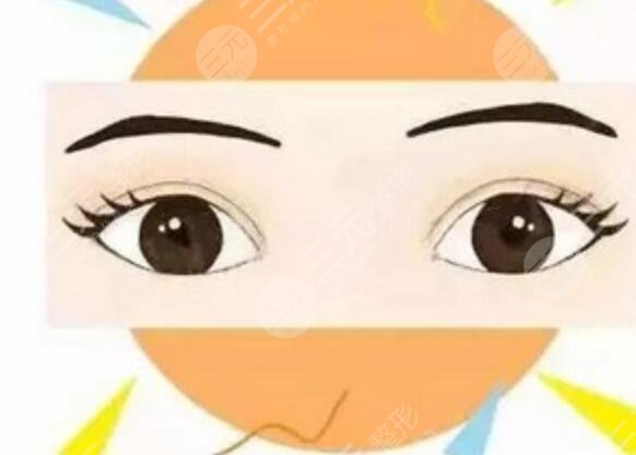 兰州军区总医院整形科双眼皮后3天