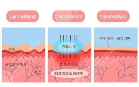 东莞人民医院激光美容果怎么样?