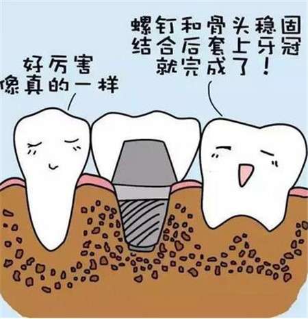 广州种植牙医院排行榜更新！快来查看是否有您心仪的医疗机构！