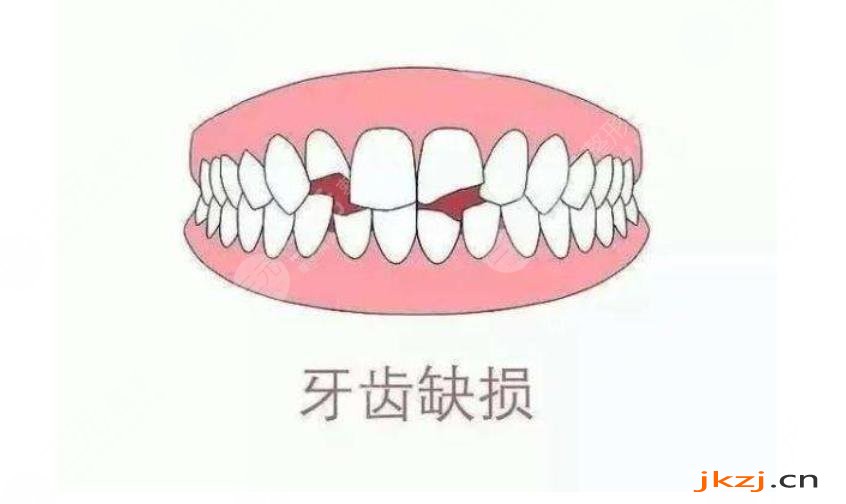 牙齿缺损修复的原理