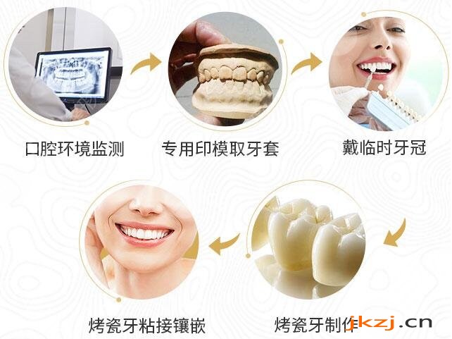 修复牙齿