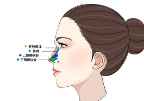 鼻子6.jpg