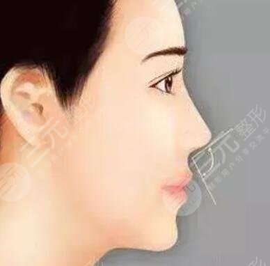 汪春兰